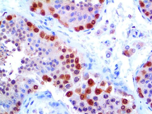 IHC of PGP 9.5 on an FFPE Testicle Tissue